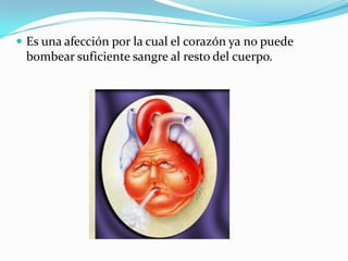  Es una afección por la cual el corazón ya no puede
 bombear suficiente sangre al resto del cuerpo.
 