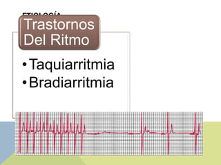 ETIOLOGÍA
Trastornos
Del Ritmo
• Taquiarritmia
• Bradiarritmia
 
