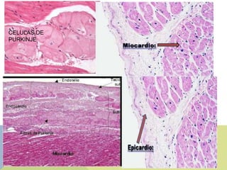 CELULAS DE
PURKINJE




         miocardio
 