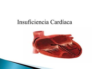 Insuficiencia Cardíaca
 