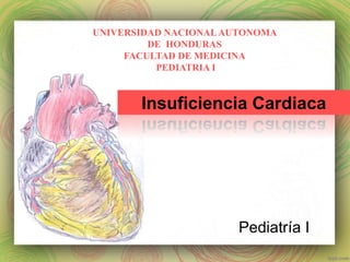 Pediatría I
Insuficiencia Cardiaca
UNIVERSIDAD NACIONALAUTONOMA
DE HONDURAS
FACULTAD DE MEDICINA
PEDIATRIA I
 
