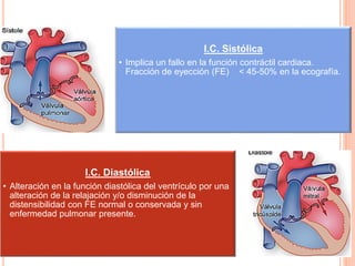I.C. Sistólica
• Implica un fallo en la función contráctil cardiaca.
Fracción de eyección (FE) < 45-50% en la ecografía.
I.C. Diastólica
• Alteración en la función diastólica del ventrículo por una
alteración de la relajación y/o disminución de la
distensibilidad con FE normal o conservada y sin
enfermedad pulmonar presente.
 