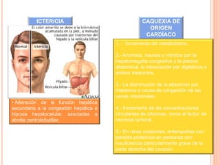 ICTERICIA CAQUEXIA DE
ORIGEN
CARDÍACO
• Alteración de la función hepática
secundaria a la congestión hepática e
hipoxia hepatocelular, asociadas a
atrofia centrolobulillar.
1.- Incremento del metabolismo.
2.- Anorexia, nausea y vómitos por la
hepatomegalia congestiva y la pletora
abdominal, la intoxicación por digitalicos o
ambos trastornos.
3.- La disminución de la absorción por
intestinos a causa de congestión de las
venas intestinales.
4.- Incremento de las concentraciones
circulantes de citocinas, como el factor de
necrosis tumoral.
5.- En raras ocasiones, enteropatías con
pérdida proteínica en personas con
insuficiencia particularmente grave de la
parte derecha del corazón.
 