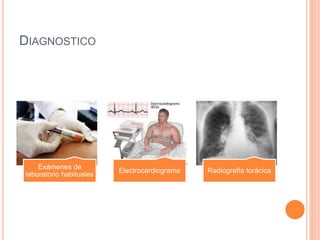 DIAGNOSTICO
Exámenes de
laboratorio habituales
Electrocardiograma Radiografía torácica
 