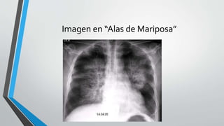Imagen en “Alas de Mariposa”
 