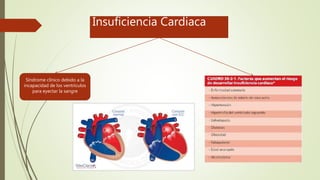 Insuficiencia Cardiaca
Síndrome clínico debido a la
incapacidad de los ventrículos
para eyectar la sangre
 