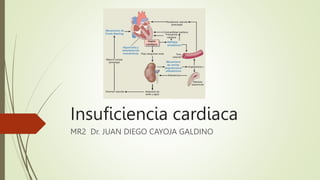 Insuficiencia cardiaca
MR2 Dr. JUAN DIEGO CAYOJA GALDINO
 