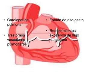 • Cardiopatías 
pulmonar 
• Trastornos 
vasculares 
pulmonares 
• Estado de alto gasto 
• Requerimientos 
excesivos de flujo 
sanguíneo 
 
