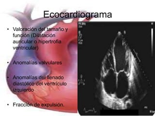 Ecocardiograma 
• Valoración del tamaño y 
función (Dilatación 
auricular o hipertrofia 
ventricular) 
• Anomalías valvulares 
• Anomalías del llenado 
diastólico del ventrículo 
izquierdo 
• Fracción de expulsión. 
 
