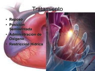 Tratamiento 
• Reposo 
• Posición 
Semisentada 
• Administración de 
Oxigeno 
• Restricción Hídrica 
 