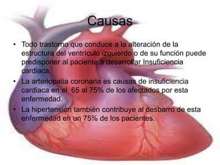 Causas 
• Todo trastorno que conduce a la alteración de la 
estructura del ventrículo izquierdo o de su función puede 
predisponer al paciente a desarrollar Insuficiencia 
cardiaca. 
• La arteriopatia coronaria es causas de insuficiencia 
cardiaca en el 65 al 75% de los afectados por esta 
enfermedad. 
• La hipertensión también contribuye al desbarro de esta 
enfermedad en un 75% de los pacientes. 
 