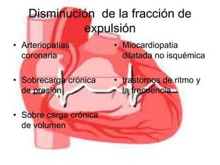 Disminución de la fracción de 
expulsión 
• Arteriopatias 
coronaria 
• Sobrecarga crónica 
de presión 
• Sobre carga crónica 
de volumen 
• Miocardiopatia 
dilatada no isquémica 
• trastornos de ritmo y 
la frecuencia 
 