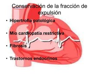 Conservación de la fracción de 
expulsión 
• Hipertrofia patológica 
• Mio cardiopatía restrictiva 
• Fibrosis 
• Trastornos endocrinos 
 