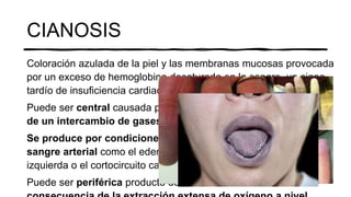 Insuficiencia cardiaca (1).pptx