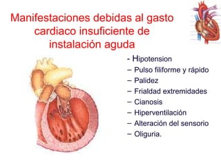 Manifestaciones debidas al gasto
cardiaco insuficiente de
instalación aguda
- Hipotension
–
–
–
–
–
–
–

Pulso filiforme y rápido
Palidez
Frialdad extremidades
Cianosis
Hiperventilación
Alteración del sensorio
Oliguria.

 
