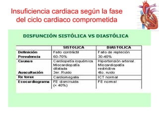 Insuficiencia cardiaca según la fase
del ciclo cardiaco comprometida

 