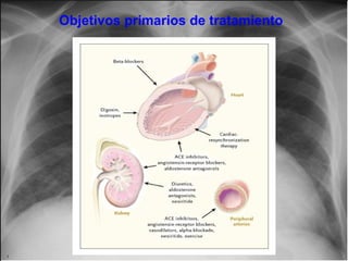 Objetivos primarios de tratamiento

 