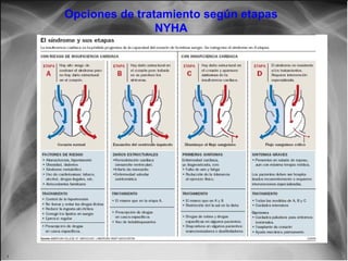 Opciones de tratamiento según etapas
NYHA

Jessup,M.Brozena,S.Heart failure.NEJM.Mayo 15,2003

 