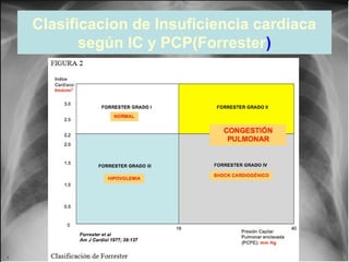 Clasificacion de Insuficiencia cardiaca
según IC y PCP(Forrester)

Jessup,M.Brozena,S.Heart failure.NEJM.Mayo 15,2003

 