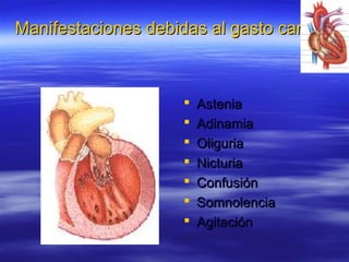Manifestaciones debidas al gasto cardiacoManifestaciones debidas al gasto cardiaco i
 AsteniaAstenia
 AdinamiaAdinamia
 OliguriaOliguria
 NicturiaNicturia
 ConfusiónConfusión
 SomnolenciaSomnolencia
 AgitaciónAgitación
 
