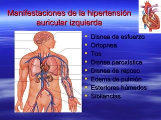 Manifestaciones de la hipertensiónManifestaciones de la hipertensión
auricular izquierdaauricular izquierda
 Disnea de esfuerzoDisnea de esfuerzo
 OrtopneaOrtopnea
 TosTos
 Disnea paroxísticaDisnea paroxística
 Disnea de reposoDisnea de reposo
 Edema de pulmónEdema de pulmón
 Estertores húmedosEstertores húmedos
 SibilanciasSibilancias
 