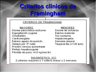 Criterios clínicos deCriterios clínicos de
FraminghamFramingham
 