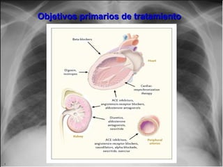 Objetivos primarios de tratamientoObjetivos primarios de tratamiento
 