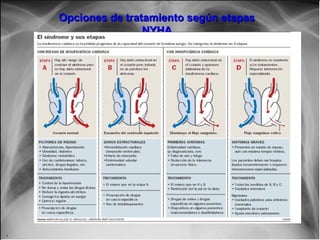 Jessup,M.Brozena,S.Heart failure.NEJM.Mayo 15,2003
Opciones de tratamiento según etapasOpciones de tratamiento según etapas
NYHANYHA
 