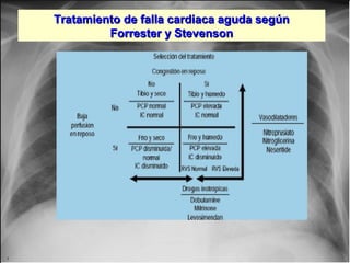 Jessup,M.Brozena,S.Heart failure.NEJM.Mayo 15,2003
Tratamiento de falla cardiaca aguda segúnTratamiento de falla cardiaca aguda según
Forrester y StevensonForrester y Stevenson
 