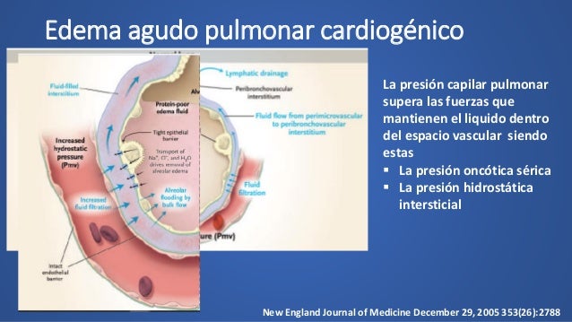 Insuficiencia cardiaca congestiva y edema pulmonar agudo