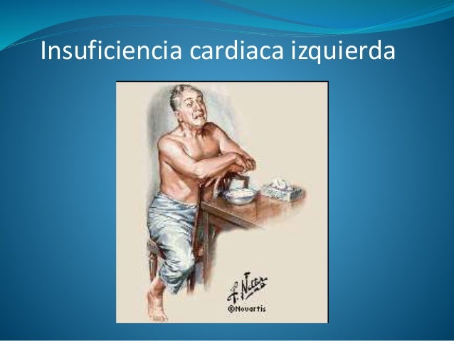 Que es útil la zanahoria cruda para el adelgazamiento