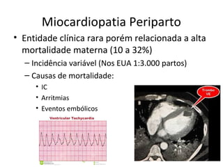 Miocardiopatia Periparto
• Entidade clínica rara porém relacionada a alta
mortalidade materna (10 a 32%)
– Incidência variável (Nos EUA 1:3.000 partos)
– Causas de mortalidade:
• IC
• Arritmias
• Eventos embólicos
 