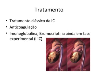 Tratamento
• Tratamento clássico da IC
• Anticoagulação
• Imunoglobulina, Bromocriptina ainda em fase
experimental (IIIC)
 