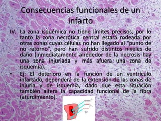 Consecuencias funcionales de un
infarto
IV. La zona isquémica no tiene límites precisos, por lo
tanto la zona necrótica central estará rodeada por
otras zonas cuyas células no han llegado al “punto de
no retorno”, pero han sufrido distintos niveles de
daño (inmediatamente alrededor de la necrosis hay
una zona injuriada y más afuera una zona de
isquemia).
• Ej: El deterioro en la función de un ventrículo
infartado, dependerá de la extensión de las zonas de
injuria y de isquemia, dado que esta situación
también altera la capacidad funcional de la fibra
(aturdimiento).
 