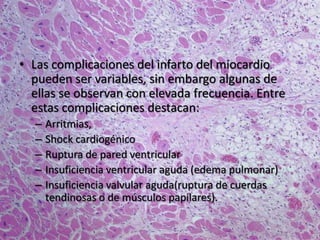 • Las complicaciones del infarto del miocardio
pueden ser variables, sin embargo algunas de
ellas se observan con elevada frecuencia. Entre
estas complicaciones destacan:
– Arritmias,
– Shock cardiogénico
– Ruptura de pared ventricular
– Insuficiencia ventricular aguda (edema pulmonar)
– Insuficiencia valvular aguda(ruptura de cuerdas
tendinosas o de músculos papilares).
 
