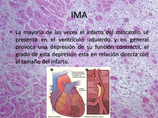IMA
• La mayoría de las veces el infarto del miocardio se
presenta en el ventrículo izquierdo y en general
provoca una depresión de su función contráctil, el
grado de esta depresión esta en relación directa con
el tamaño del infarto.
 