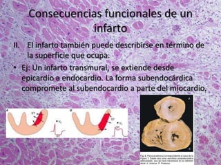 Consecuencias funcionales de un
infarto
II. El infarto también puede describirse en término de
la superficie que ocupa.
• Ej: Un infarto transmural, se extiende desde
epicardio a endocardio. La forma subendocárdica
compromete al subendocardio a parte del miocardio.
 