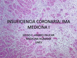 INSUFICIENCIA CORONARIA: IMA
MEDICINA I
HILGO C. AMARO PAUCAR
MEDICINA HUMANA
UNFV
 
