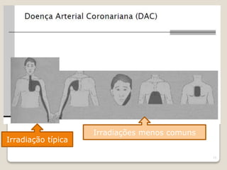 13 
Irradiação típica 
Irradiações menos comuns 
 