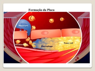 21 
Formação da Placa 
 