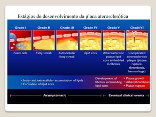 22 
Estágios de desenvolvimento da placa aterosclerótica 
 