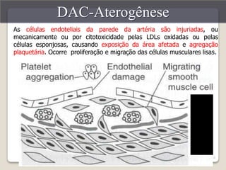 As células endoteliais da parede da artéria são injuriadas, ou 
mecanicamente ou por citotoxicidade pelas LDLs oxidadas ou pelas 
células esponjosas, causando exposição da área afetada e agregação 
plaquetária. Ocorre proliferação e migração das células musculares lisas. 
24 
DAC-Aterogênese 
 