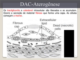 Os tracilgliceróis e colesterol intracelular são liberados e se acumulam. 
Ocorre a secreção de material fibroso que forma uma capa. As células 
começam a morrer. 
25 
DAC-Aterogênese 
 