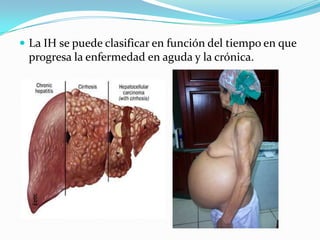  La IH se puede clasificar en función del tiempo en que
progresa la enfermedad en aguda y la crónica.
 