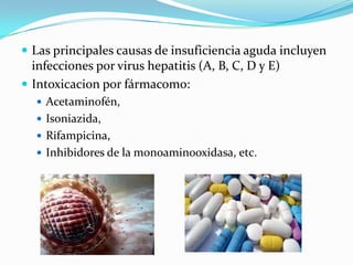  Las principales causas de insuficiencia aguda incluyen
infecciones por virus hepatitis (A, B, C, D y E)
 Intoxicacion por fármacomo:
 Acetaminofén,
 Isoniazida,
 Rifampicina,
 Inhibidores de la monoaminooxidasa, etc.
 