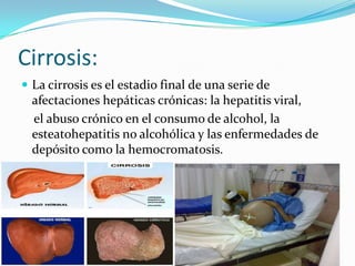 Cirrosis:
 La cirrosis es el estadio final de una serie de
afectaciones hepáticas crónicas: la hepatitis viral,
el abuso crónico en el consumo de alcohol, la
esteatohepatitis no alcohólica y las enfermedades de
depósito como la hemocromatosis.
 
