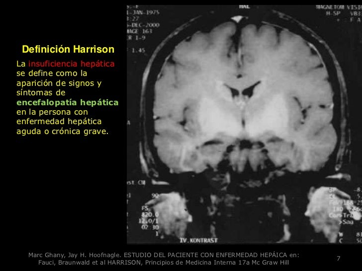 Морфологические изменения головного мозга. Морфологические изменения головного мозга. Морфологические изменения головного мозга. Морфологические изменения головного мозга. Аминоацидурия.