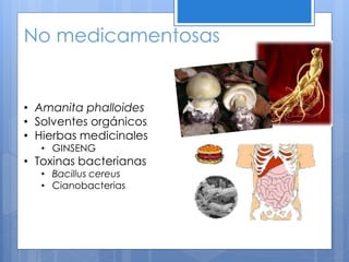 No medicamentosas
• Amanita phalloides
• Solventes orgánicos
• Hierbas medicinales
• GINSENG
• Toxinas bacterianas
• Bacillus cereus
• Cianobacterias
 