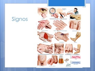 Signos
 