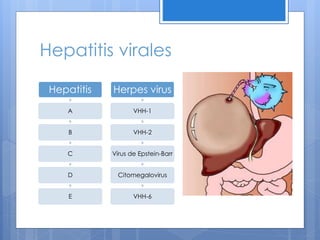 Hepatitis virales
Hepatitis
A
B
C
D
E
Herpes virus
VHH-1
VHH-2
Vírus de Epstein-Barr
Citomegalovirus
VHH-6
 